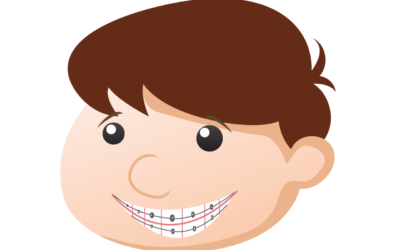 Tratamiento de ortodoncia en pacientes con implantes dentales